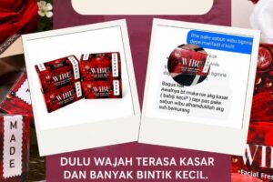 Kulit yang bersih dan terawat bikin tampil lebih percaya diri!