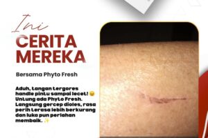 Cuma Gara-Gara Handle Pintu, Tangan Jadi Lecet! Untung Ada Phyto Fresh 😱